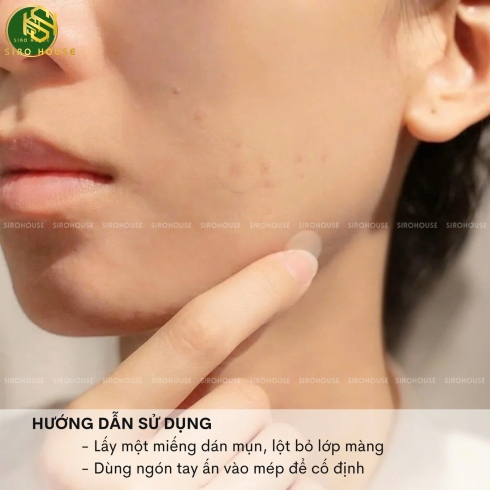 Miếng dán mụn CNP Laboratory Anti-Blemish Spot Patch 72 miếng 