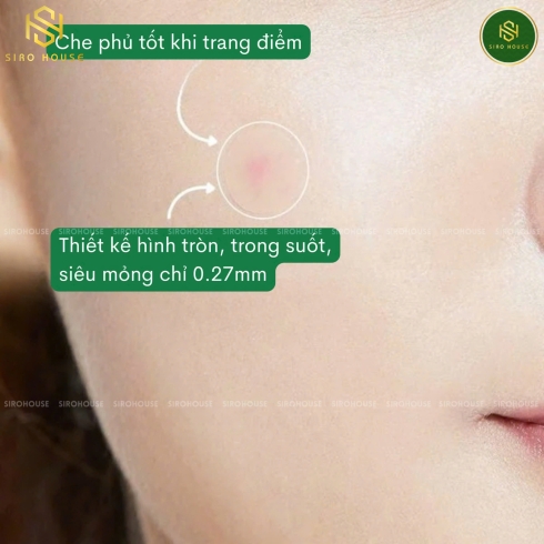 Miếng dán mụn CNP Laboratory Anti-Blemish Spot Patch 72 miếng 