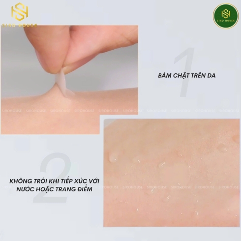 Miếng dán mụn CNP Laboratory Anti-Blemish Spot Patch 72 miếng 