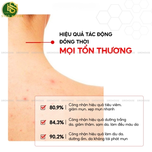 Sữa dưỡng thể trắng da, ngừa mụn TIA