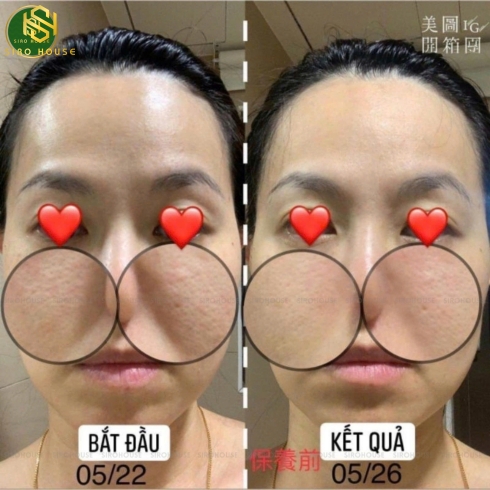Tinh chất peel da tái tạo chuyên sâu CNP Rx Skin Rejuvenating Intensive Peel 2mL