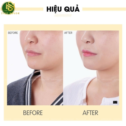 Kem chống nắng MARTI DERM The Originals Proteos Screen SPF50+ Fluid Cream Light 40mL