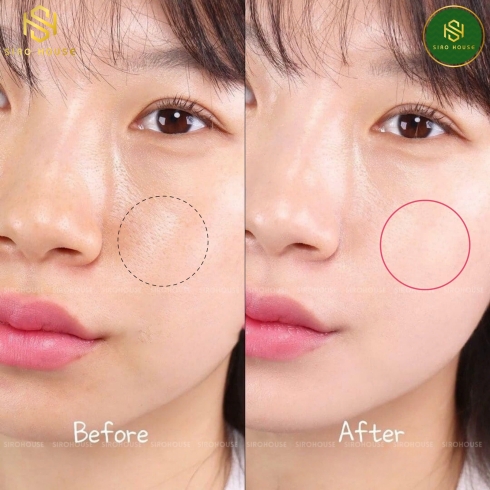 Kem chống nắng DR.G Medi Uv Moisture Tone Up Sun SPF50+ 50mL