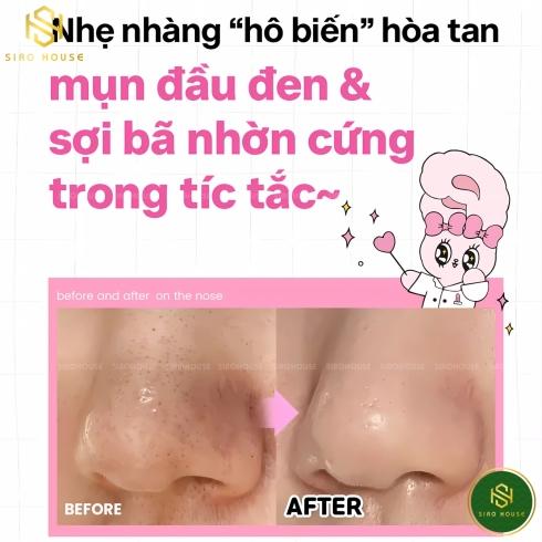 Ủ mụn ILSO Melting Sebum Softener 150g + 40 Bông