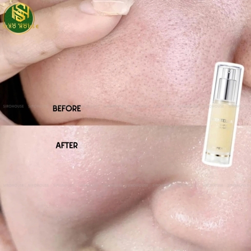 Tinh chất DR.PEPTI Centella Dark Spot Solution Ampoule 30mL