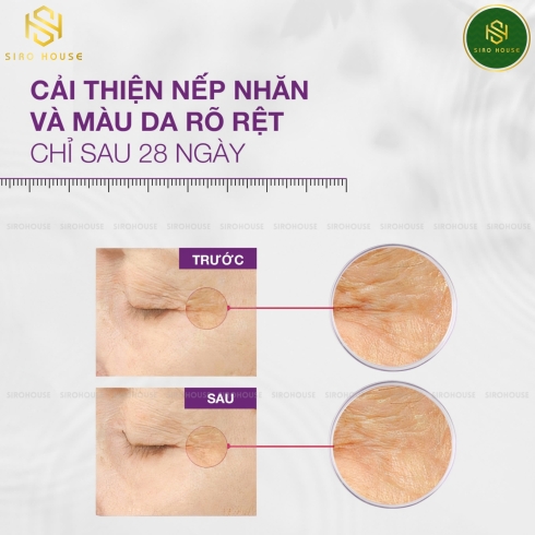 Tinh chất tế bào gốc tái tạo, trẻ hóa da SKINCLINIC P.R.P Serum 30mL