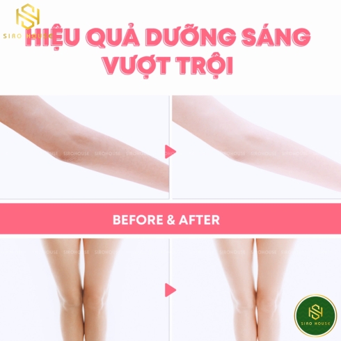 Sữa dưỡng thể trắng da WHISIS Whitening Body Lotion 300mL