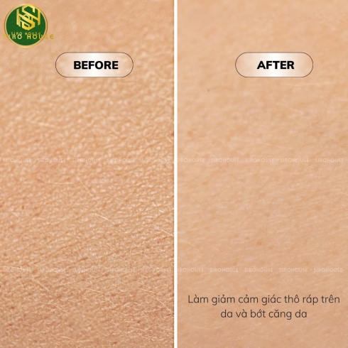 Dưỡng Thể Vaseline 1000ml 