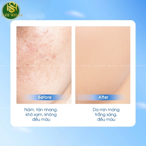 Viên uống trắng da RELUMINS 1650mg 90 viên