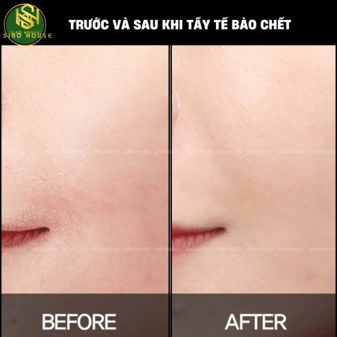 Tẩy tế bào chết ARRAHAN thảo dược 180mL 