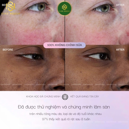  Tinh chất dưỡng da Super Serum OLAY Power Of 5 Serum Benefits In One 30mL 