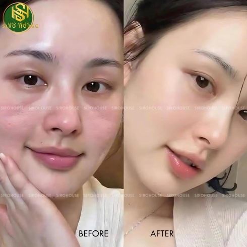 Kem dưỡng phục hồi da AVENE Cicalfate+ Repair Cream 40ml  & 100ml