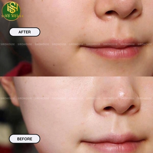  Bộ 3 Serum Timeless Đình Đám: Dưỡng Ẩm – Phục Hồi – Làm Sáng Da Toàn Diện 