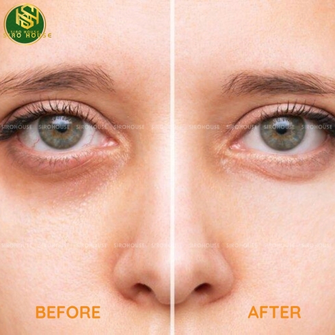 Nạ mắt MEDIANSWER Vita Collagen Eye Cream Patch 60 miếng 