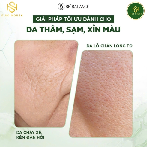 Mặt nạ vải vi sợi ngải cứu BE