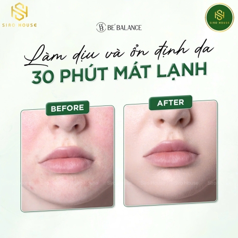 Mặt nạ vải vi sợi ngải cứu BE