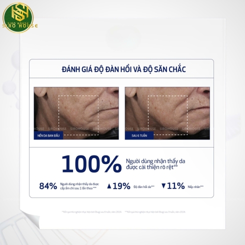 Kem dưỡng chống lão hoá, ngừa mụn OBAGI Retinol 0.5% & 1.0%