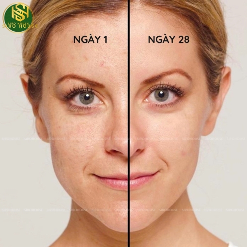 Kem dưỡng chống lão hoá, ngừa mụn OBAGI Retinol 0.5% & 1.0%