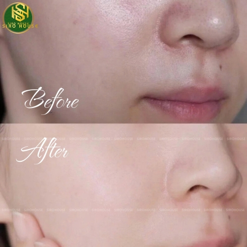 Gel tẩy tế bào chết chiết xuất rau má DR.PEPTI Centella Turnover Soft Peeling Gel 100mL