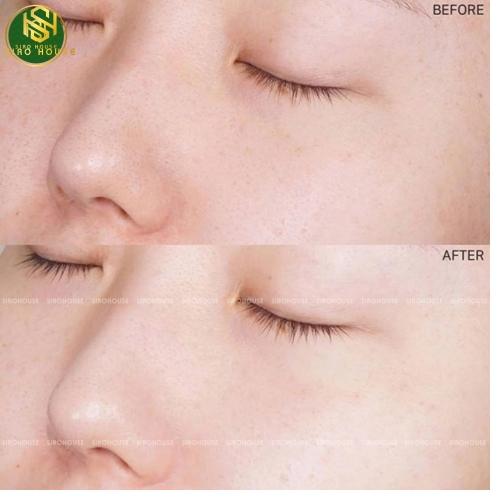 Tẩy da chết COMPLIMENT No Problem Cleansing Gel Scrub 150mL & Peeling Roll Salicylic Acid 80mL