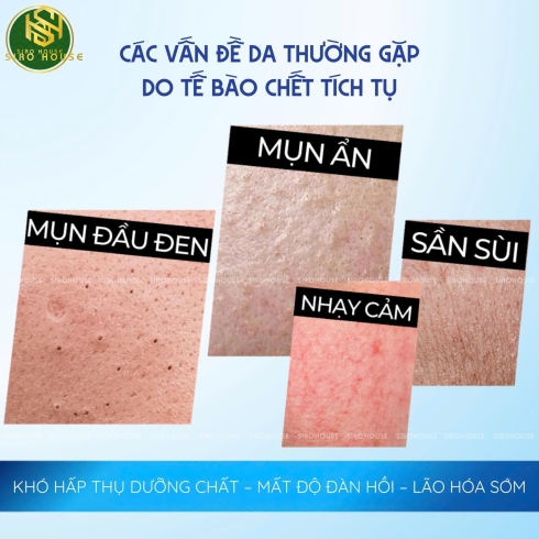 Tẩy da chết COMPLIMENT No Problem Cleansing Gel Scrub 150mL & Peeling Roll Salicylic Acid 80mL