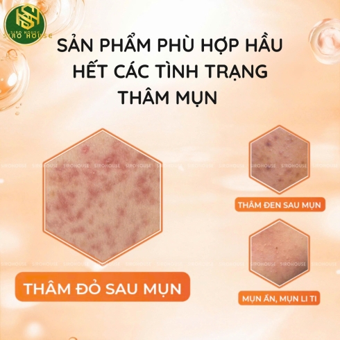 Kem giảm mụn mờ thâm mụn SKINOREN KREM 30g 