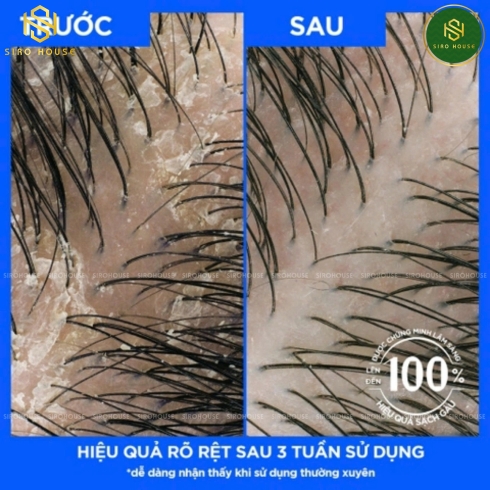 Dầu gội CLEAR Men Cool Sport Menthol 480mL & Dầu gội CLEAR Ice Cool Menthol 450mL   