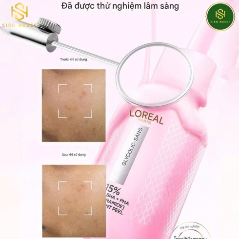 Tinh chất làm sạch da chết L