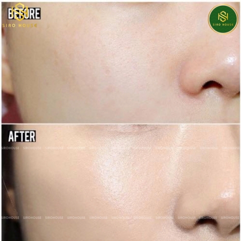 Tẩy da chết sạch da, dưỡng ẩm INNISFREE Green Barley Mild Peeling Gel 120mL
