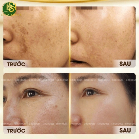 Collagen nước NMN Hinode Collagen 10 chai x 50mL