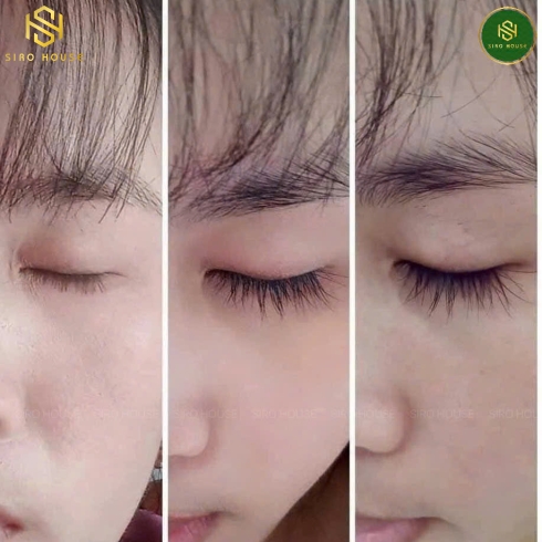 Dưỡng Mi FEG Eyebrow Enhancer 3mL & FEG Pro Advanced 3mL