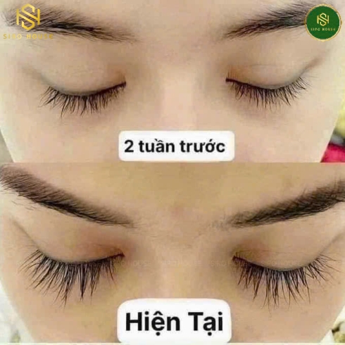 Dưỡng Mi FEG Eyebrow Enhancer 3mL & FEG Pro Advanced 3mL