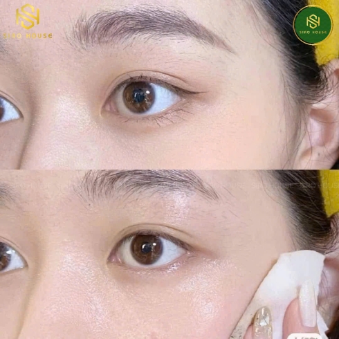 Nước tẩy trang SVR Sebiaclear Eau Micellaire 400mL