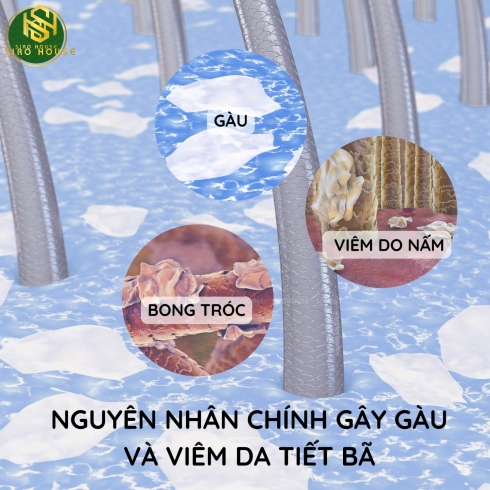 Dầu Gội Trị Gàu SELSUN BLUE 325mL (Cleanse & Conditions 2-in-1, Medicated, Itchy Dry Scalp, Moisturizing with Aloe, Naturals Itchy Dry Scalp)