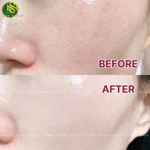 Nước cân bằng NMN White Skin Lotion 500mL